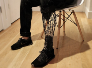 Spersonalizowana proteza nogi - druk 3D